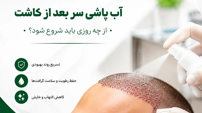 آب پاشی سر بعد از کاشت از چه روزی باید شروع بشود؟
